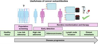 Autoantibodies in cancer: a systematic review of their clinical role in the most prevalent cancers